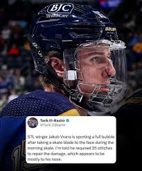 😳 This is why the league wants...