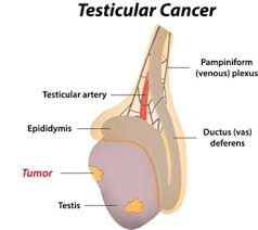 What conditions are linked to it? Clinical Research On Testicular Cancer Cruk Cc