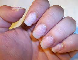 Acrylic Nails Taken Off New Expression Nails