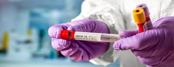 Важно знать, что при отсутствии. Pcr Test V Kieve Ceny Na Pcr Test Na Koronavirus Projti Test Na Koronavirus Otzyvy