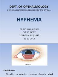 Image result for Hyphema