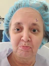 How long u resume driving after operation?