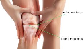 Exercises should only be done on the advice of your doctor and only if you. Acupuncture Improves Knee Meniscus Repair