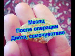 диета после удаления желчного пузыря через 1 5 месяца Mesyac Posle Udaleniya Dieta Obraz Zhizni Oslozhneniya Youtube