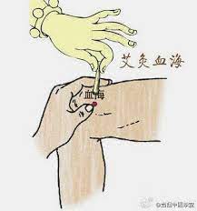 经期头痛 很多人在经期经常容易头痛 一般而言 月经来前头痛多属气滞 常伴有乳房胸胁胀痛 烦躁易怒 可以多按揉太冲穴疏肝解郁理气 而月经过后头痛多属血虚 伴疲乏无力 经血色淡 可以多按揉或者艾灸血海穴以补血养血 acupunture alternative medicine