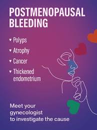 Image result for Postmenopausal Bleeding
