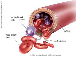 Image result for pictures of leukemia