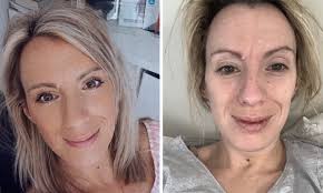 Aberdeen long Covid sufferer travelling to Germany for treatment