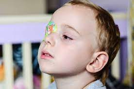 How To Fix A Lazy Eye | Amblyopia Treatment | Correction W/ Vision Therapy,  Eye Patching And/Or Surgery For Children And Adults