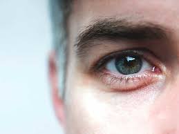 Image result for Mydriasis