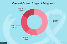 How is cervical cancer treated? How Cervical Cancer Is Diagnosed