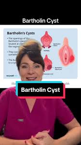 Image result for Bartholin's gland abscess