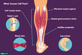 What is the anatomical term for your calf muscle of the lower leg. Calf Pain Causes Treatment And When To See A Doctor