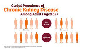 The following medical diseases or health concerns are more common in travel to malaysia (compared to the usa and other areas of the western world) Chronic Kidney Disease A Global Crisis