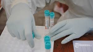 Quirónprevención carries out covid tests for passengers at exclusive prices. Swab Test Gratis Di Kecamatan Karawaci Tangerang 50 Pesertanya Positif Covid 19 Tribunnews Com Mobile