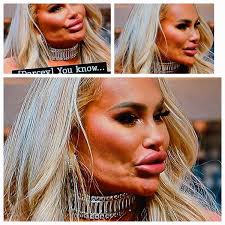 What happened to Stacey's face? That blotch