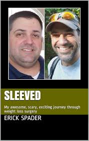 Sleeved: My awesome, scary, exciting journey through weight loss surgery  eBook : Spader, Erick: Amazon.in: Kindle Store