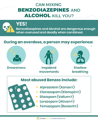 Image result for Benzodiazepine Intoxication