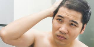 If your hair loss is caused by stress, it's possible for your hair to grow back in time. Study Divorce Can Cause Hair Loss Men S Divorce