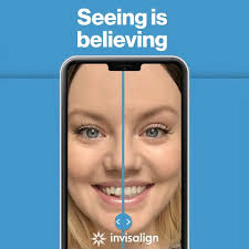 Download the My Invisalign app!