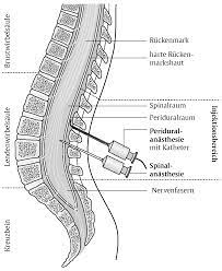 Einführung, geschichte, physiologische grundlagen sicherung der atemwege, inhalationsanästhesie intubation, intravenöse anästhesie, sedierung beatmung, blutgasanalyse voruntersuchungen. Https Www Sana De Media Kliniken Lichtenberg 1 Medizin Pflege Frauenklinik Geburtshilfe Geburtsdokumente Thieme Aufklaerungsbogen Anaesthesie Pdf