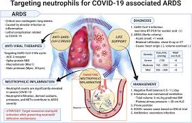 Ear infections, often called otitis media, occur when fluid collects behind the ear drum and becomes infected. Frontiers Targeting Neutrophils To Treat Acute Respiratory Distress Syndrome In Coronavirus Disease Pharmacology