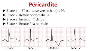 Ondes t négatives la première semaine ; Facebook
