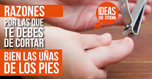 El corte de las cutículas debe evitarse porque las abrasiones y las laceraciones sirven como un portal de entrada para los organismos fúngicos. Las Razones Por Las Que Te Debes Cortar Las Unas De Los Pies