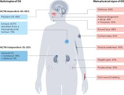 Image result for Cushing Response