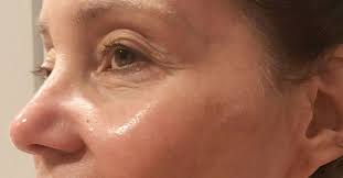 1 a he didn't mean to be rude. The 8 Best Anti Aging Serums To Try In 2021 Who What Wear