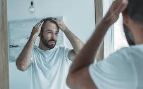 Hormoneller Haarausfall Ursachen Mittel Dagegen Haarausfall Hilfe