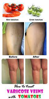 Pin On Health Fitness And Skin Care Tips