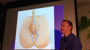 Hard spots or bumps normally occur after sex or vigorous masturbation that causes deep bruises. Genital Hair Clearing Preparing For Your Gender Reassignment Surgery 2pass Clinic