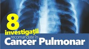 It uses substances made by the body or in a laboratory to improve how your immune system works to find and destroy cancer cells. Cancer Pulmonar Investigatii Si Simptome Youtube