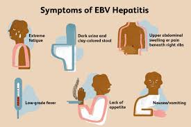Image result for hepatitis symptoms