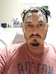 Super new to this Had a seizure few weeks ago due to encephalitis, I  haven't had a diagnosis yet but really been struggling with emotional  control, has anyone had any experience with