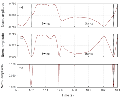 Benieuwd wat we voor u kunnen betekenen? Sensors Free Full Text Wearable Sensors System For An Improved Analysis Of Freezing Of Gait In Parkinson S Disease Using Electromyography And Inertial Signals Html