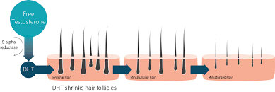 By the age of 50, more than half the men in the u.s. Does Creatine Cause Hair Loss Examine Com