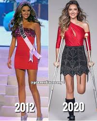 Miss universe 2018, catriona gray crowned laura olascuaga of bolívar at the end of the event. Miss Universe Colombia 2012 Daniela Alvarez Vasquez Lost Her Leg Maybelleboma S Blog
