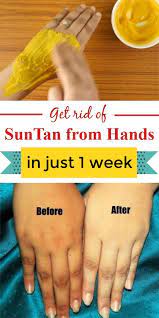 How To Remove Sun Tan From Hands In Just 1 Weeks Skin Tan Removal Sun Tan Skin Care