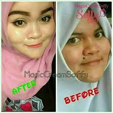 Tahi lalat yang ada di tempat tertentu tubuhmu mempunyai makna dan keberuntungan. Hot Krim Serum Parut Buang Tahi Lalat Skin Tag Mole Remover Shopee Malaysia