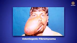 We did not find results for: Mewing Compared With Hard Mewing For A Better Face Jawline And Health Answered By Mike Mew Video Dailymotion