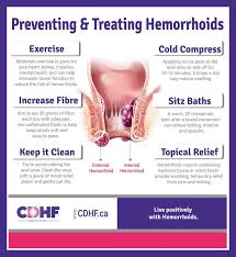 Image result for hemorrhoids