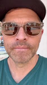 A guy got in a bike accident and said he thought it made him look like Two  Face. My friend asked me to send a “Get Well and Welcome to the Two Face  Club” message. Unfortunately, for legal reasons, I ...