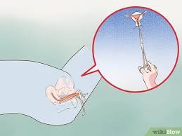 Eine Spirale Entfernen Lassen 9 Schritte Mit Bildern Wikihow