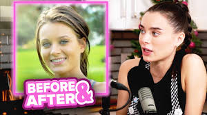 Hardx lana rhoades adriana chechik. Exposing Lana Rhoades Plastic Surgery 3 Girls 1 Kitchen Ep 2 Youtube
