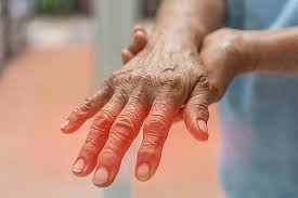 Image result for Peripheral Neuropathy