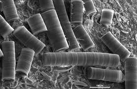 Image result for Dicoma arenaria