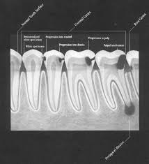 Pin On Dental Hygiene School