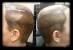 Hair Tattoo Before And After